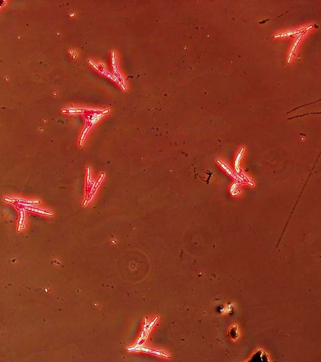 Image2 Conidia of Speiropsis pedatospora isolated from leaf samples